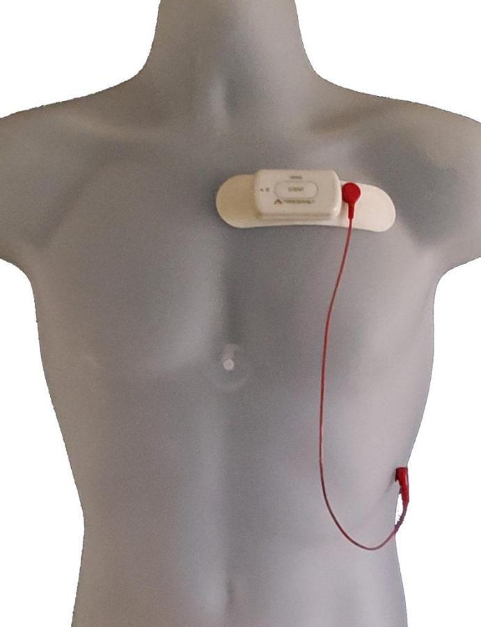 NorthEast Monitoring 1 Lead 1-3 Channel ECG Patch