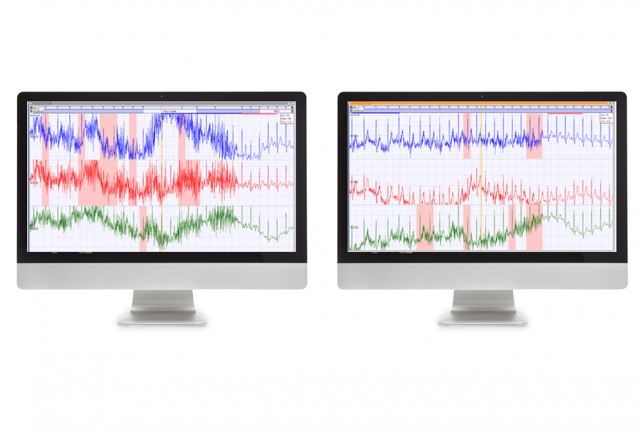 Medilog Darwin 2 Office for PC (activation code)