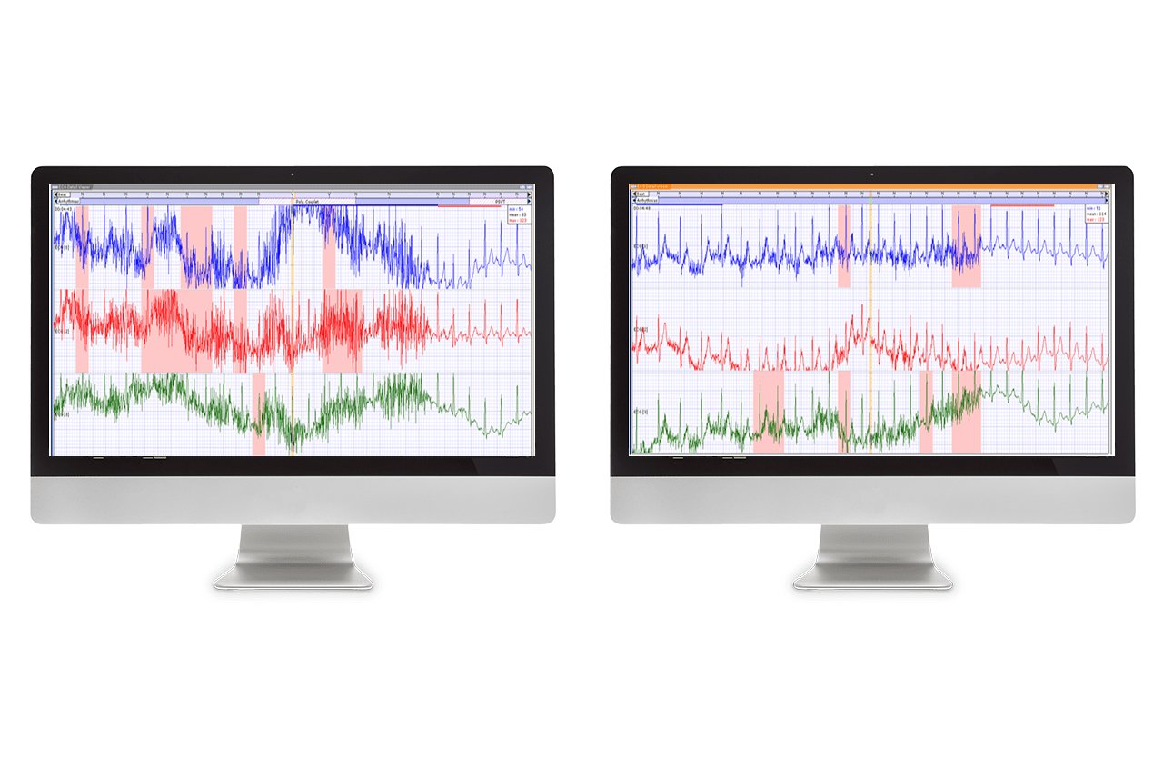 Medilog Darwin 2 Office for PC (activation code)