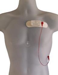 NorthEast Monitoring 1 Lead 1-3 Channel ECG Patch