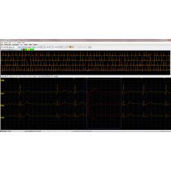 Holter LX Analysis PRO Software
